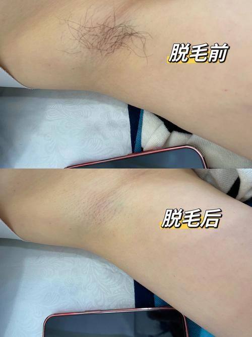 南部县人民医院(美容皮肤科)怎么样？