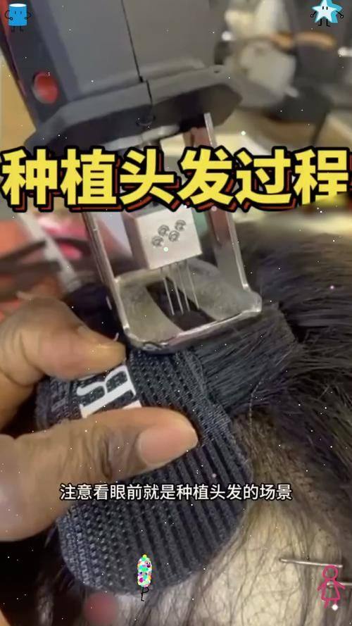 南部县人民医院(美容皮肤科)医生名单及擅长领域：