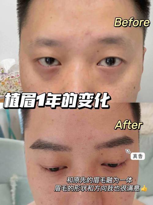 杭州碧莲盛整形医疗美容医院医生名单及擅长领域：