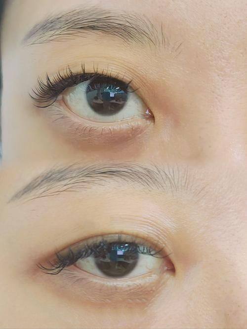 杭州碧莲盛整形医疗美容医院怎么样？