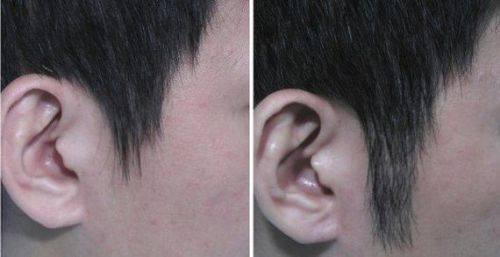 杭州碧莲盛整形医疗美容医院预约挂号方式：