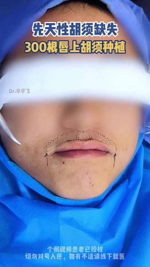 杭州碧莲盛整形医疗美容医院擅长项目：