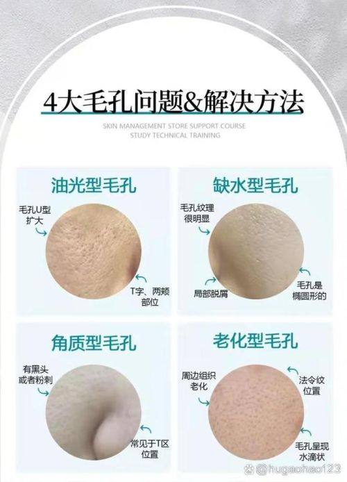 广州皮小度医疗美容诊所擅长项目：