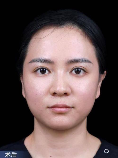 广州皮小度医疗美容诊所口碑评价：