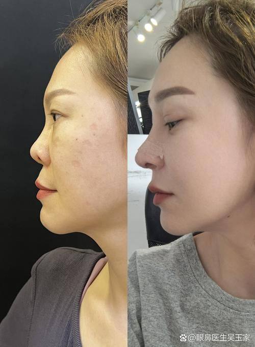 韩煜华医生擅长领域