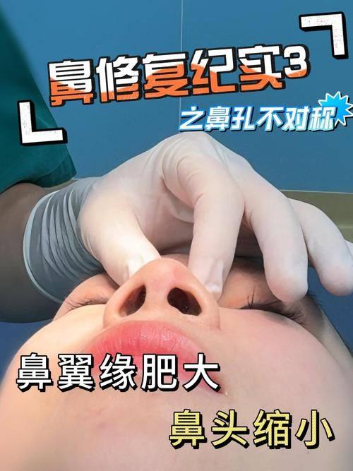 广州皮小度医疗美容诊所怎么样？