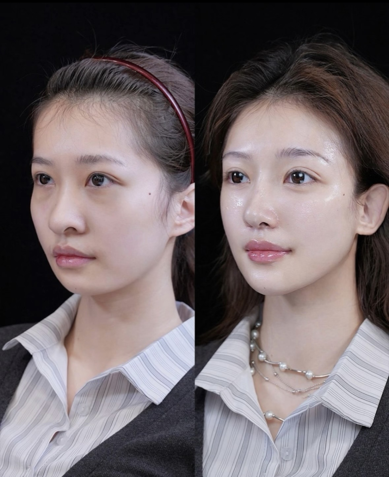 二、影响修复成效的核心因素