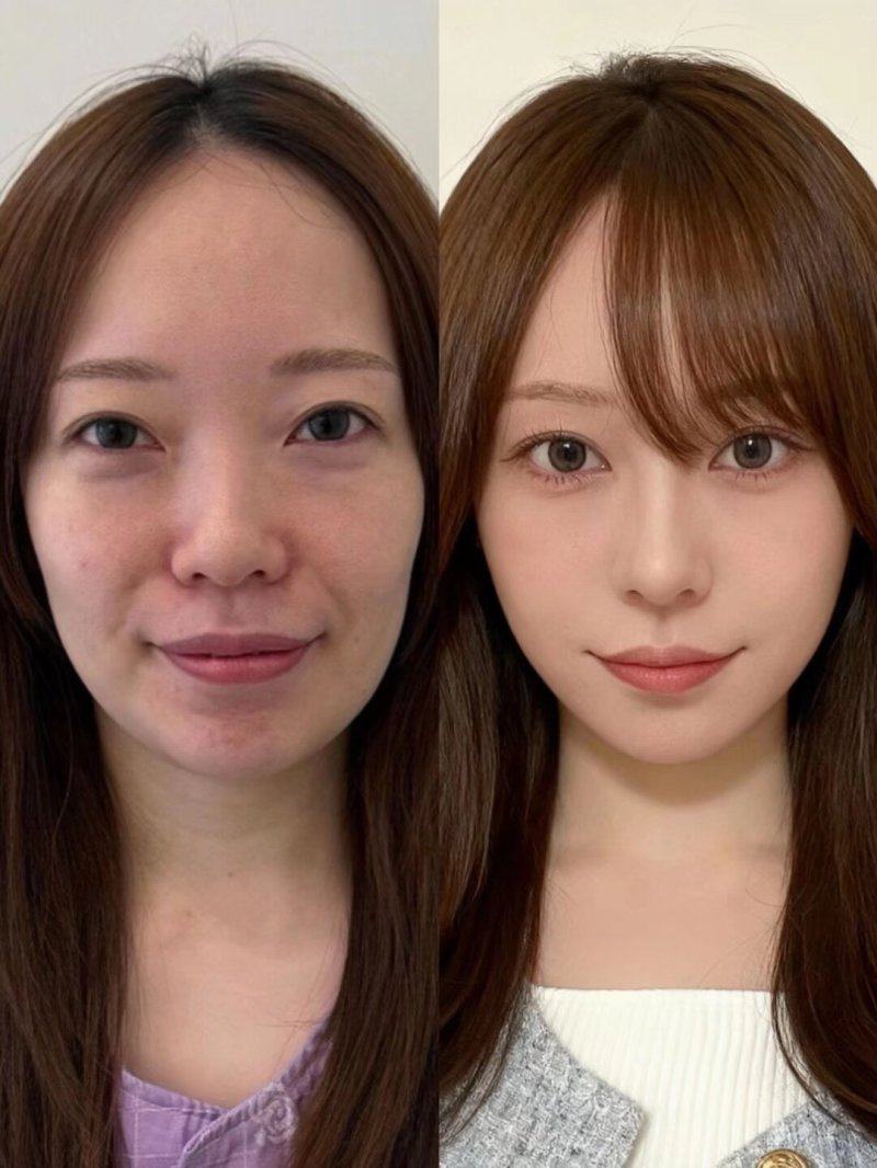 姚文磊医生技术优势