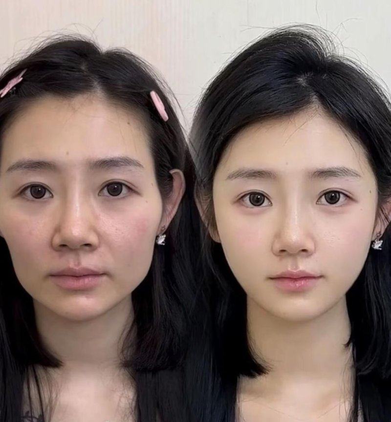 海阳韩雅美莱医疗美容门诊部地址电话及营业时间