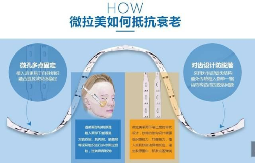 三、双眼皮多久能看出失败