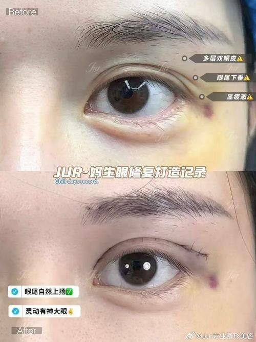 广州佳人医疗美容整形门诊部预约挂号方式：