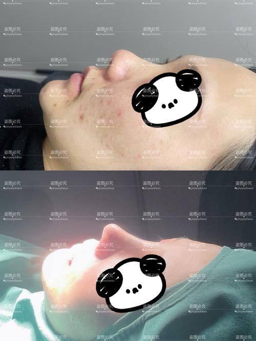 李政仁医生擅长领域