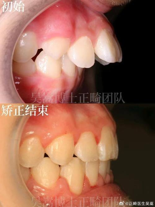 中牟顺驰口腔(中牟学苑路门诊部)价格表：
