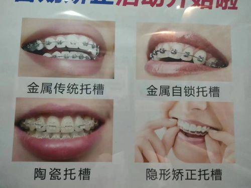 泰安妙春口腔怎么样？