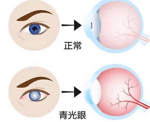 钱晓娃医生怎么预约