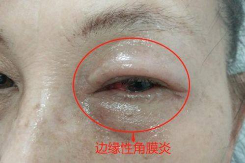 成都市温江区人民医院眼科怎么样？