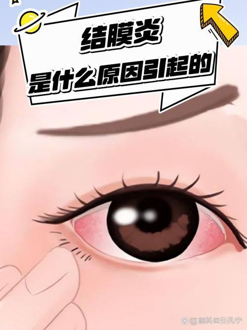 成都市温江区人民医院眼科擅长项目：