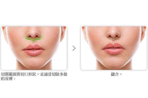 北京蕾士悦容医疗美容门诊部关丽君收费贵不贵？先看具体项目参考
