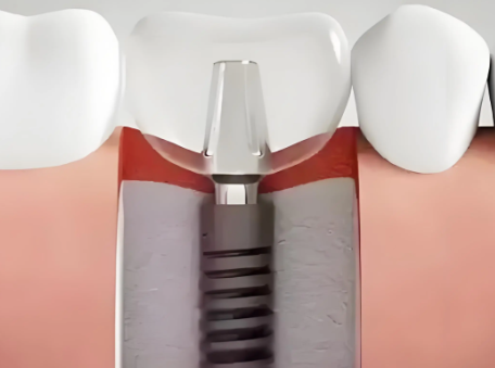 荆州青逸美植发口碑评价：
