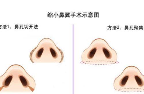 成都联和智悦医疗美容诊所怎么样？