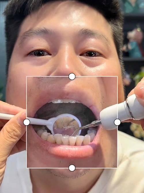 山东济南济阳重明口腔擅长项目