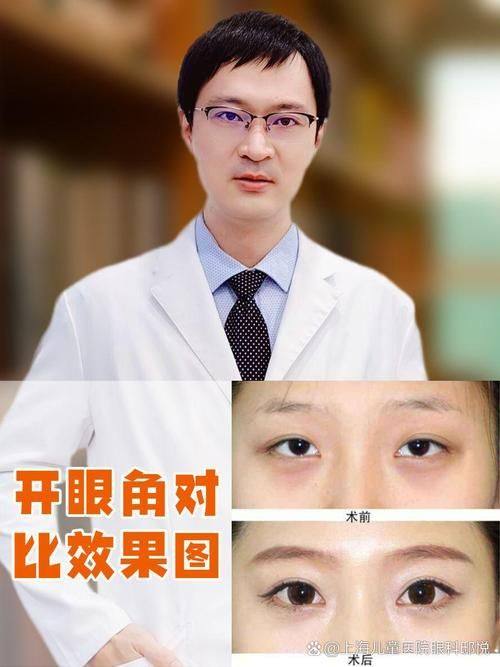 厦门畅美美容擅长项目：