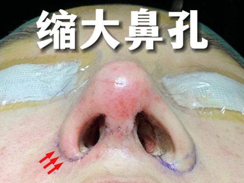 滕州格莱美医疗美容门诊部价格表