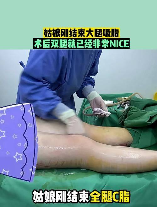 济南添美医疗美容诊所价格表