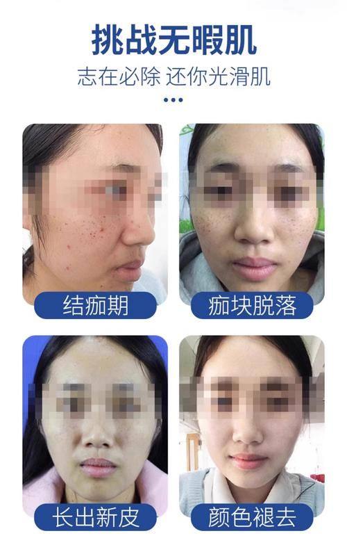 白金台皮肤科擅长项目: