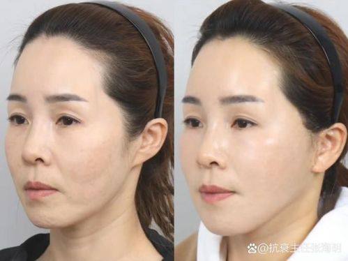 厦门畅美美容口碑评价：