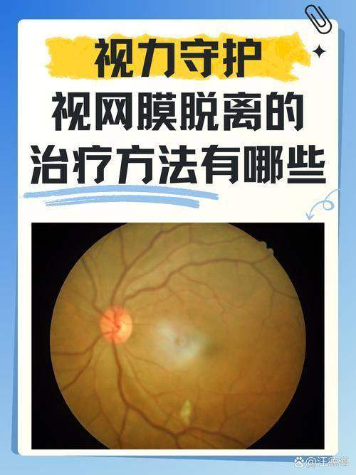云南省交通中 心医院眼科价格表：