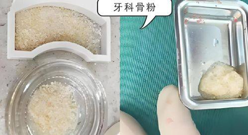 廊坊济民祥云口腔门诊部(开发区分院)价格表：