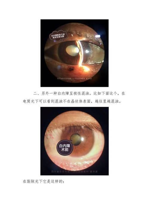 西安阿玛施眼科医院地址电话及营业时间：