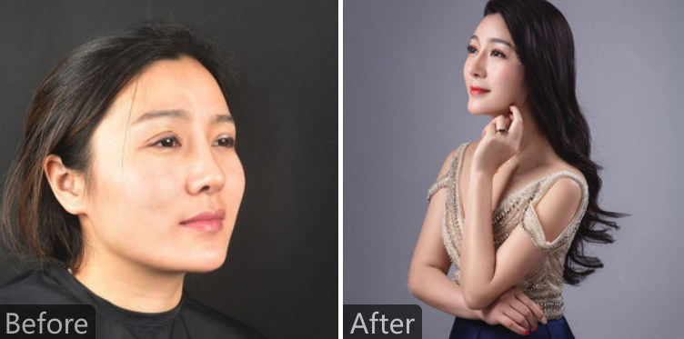 五、成都天使之翼医学美容医院预约方式