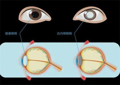 南华大学附属南华医院眼科地址电话及营业时间