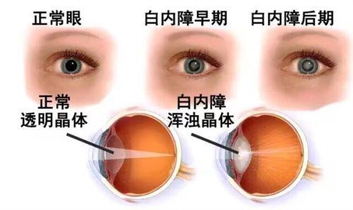 南华大学附属南华医院眼科擅长项目