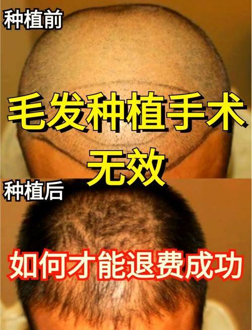 南昌大麦植发医院（原科发源）口碑评价