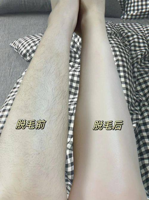 韩国Sollution皮肤科擅长项目：