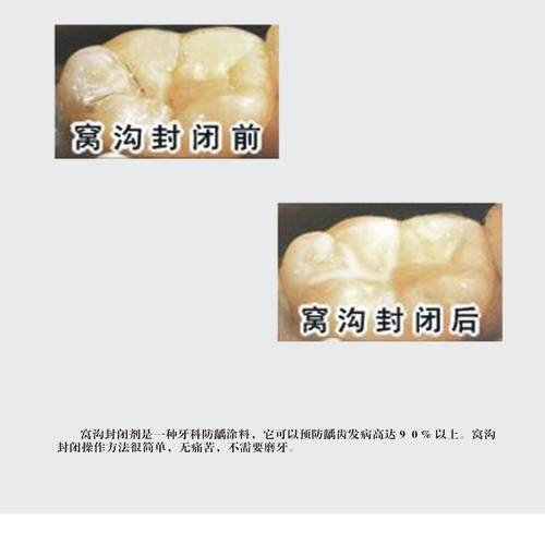 杭州临安吴云珩口腔预约挂号方式：
