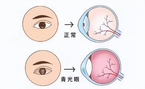 南华大学附属南华医院眼科预约挂号方式