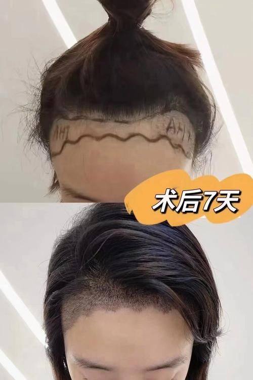 南昌大麦植发医院（原科发源）地址电话及营业时间