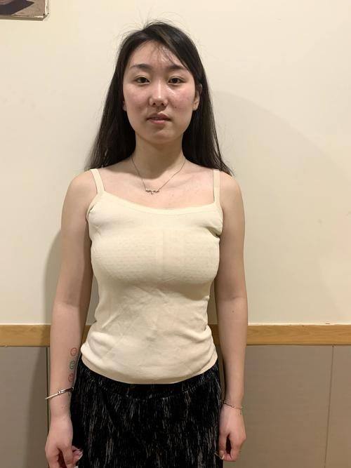 沈阳崔日香整形医院口碑评价：