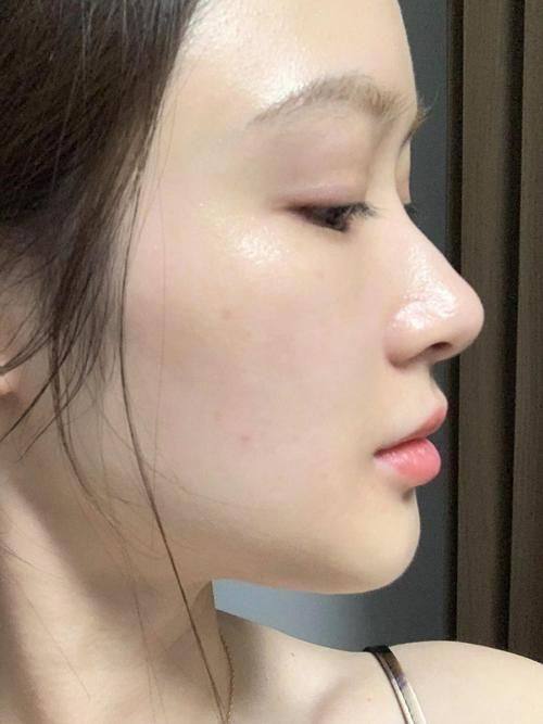 韩国Sollution皮肤科预约挂号方式：
