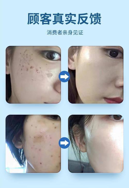李松蔚医生口碑评价