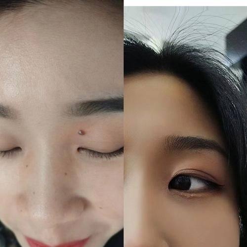 韩国Sollution皮肤科怎么样？