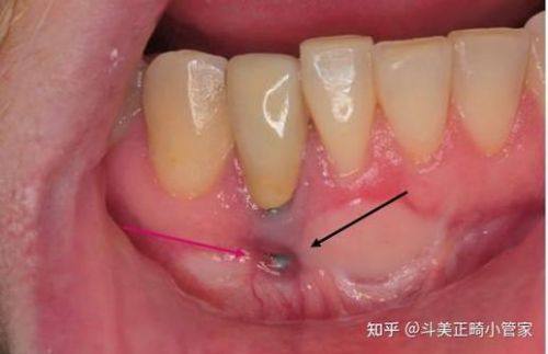 北京嘉美口腔诊所口碑评价：