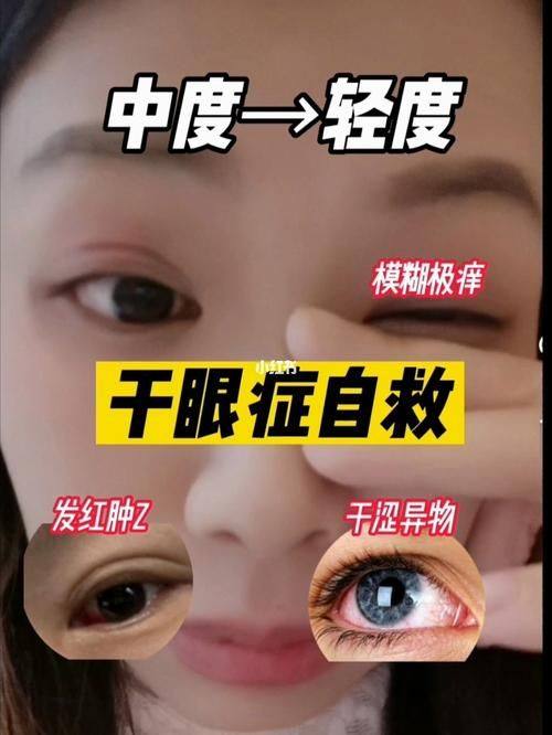 黑龙江长庚眼科医院预约挂号方式: