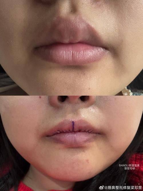 乐山莱恩医学美容门诊部擅长项目：