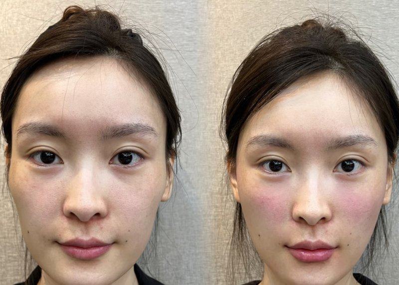 南京宁尔美医疗美容诊所价格表